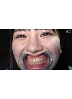 激レアな口内・歯・舌ベロ・のどちんこ観察 春日えな