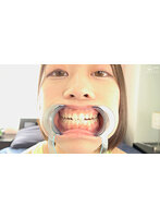 【歯・口内】奈築りおチャンの激レア 歯・口内・舌ベロ激写フェチ映像！！！